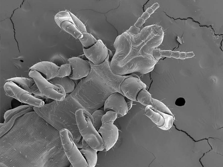 Fotografia de un piojo visto microscopio electrónico